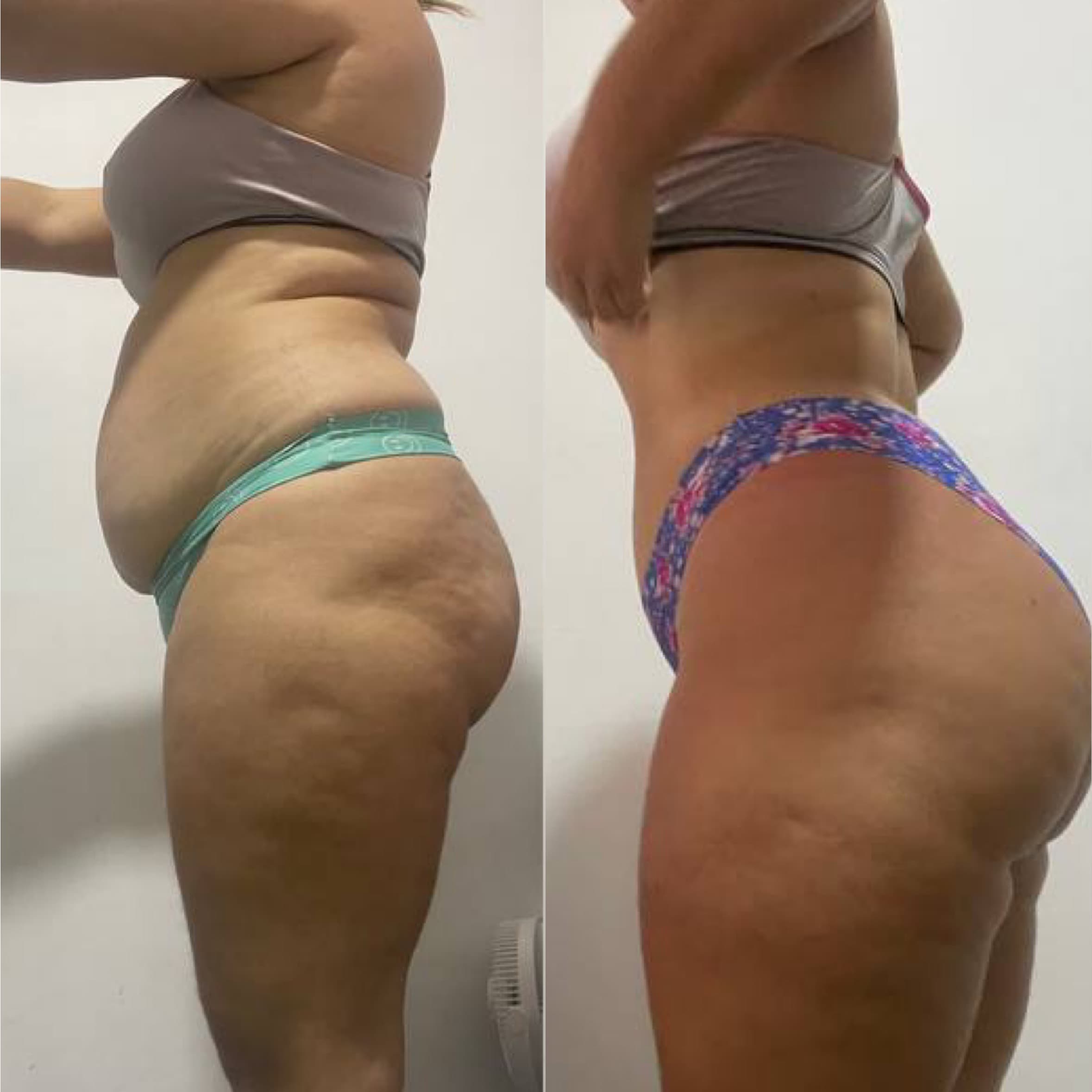 Transformación de cliente 25